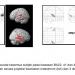 The Acquisition, Analyses and Interpretation of fMRI Data: A Study on Functional Specialisation in Primary Auditory Cortices